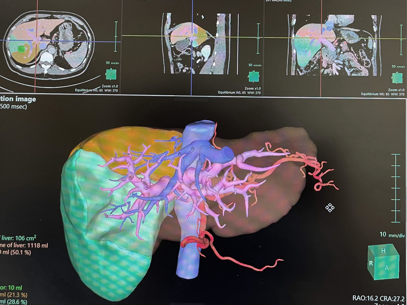 3D simulation system